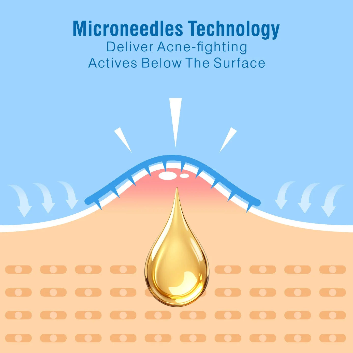 Microneedle Acne Patches™